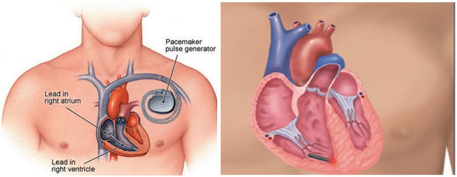 vimatodotes4